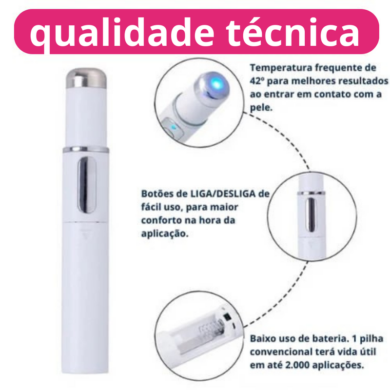 VariLife™ Removedor de varizes - Tenha pernas lisas novamente