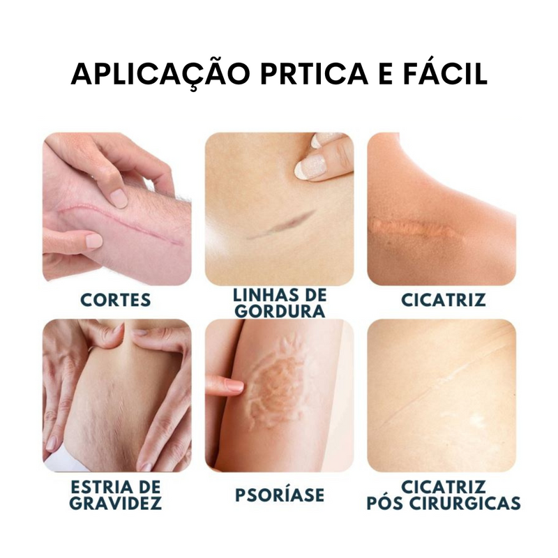 Scar - Gel Cicatrizante 100% Avançado