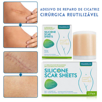 Fita Removedora de Estrias e Cicatriz - SkinFix