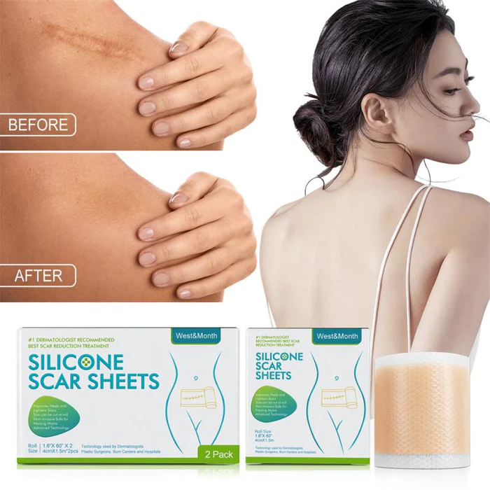 Fita Removedora de Estrias e Cicatriz - SkinFix